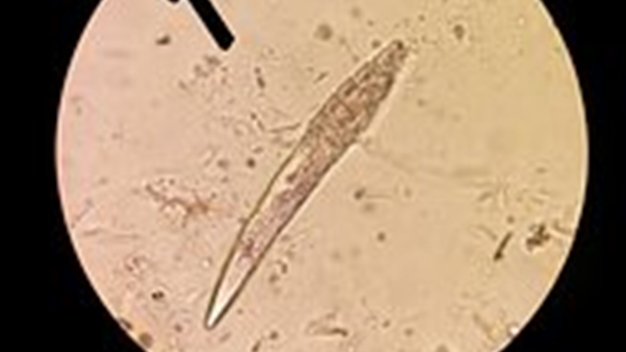 demodex folliculorum